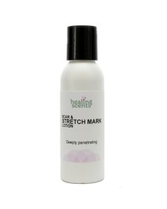 Scar & Stretch Mark Lotion, 2 oz size depicted